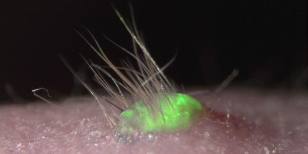 photo of Artificial skin grows hair and sweat glands image