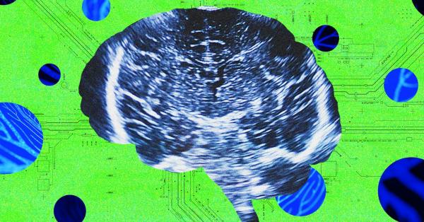 A New Neurotech Startup Launches to&hellip;