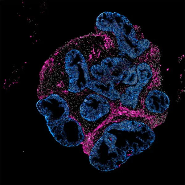 Intero Biosystems wants drugmakers to test on mini human…