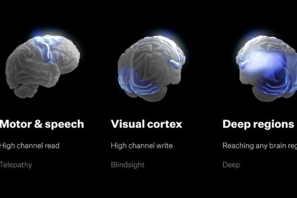 photo of Neuralink implants BCI in 7 patients, unveils roadmap for whole brain interface by 2028 image