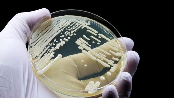 photo of This Deadly Drug-Resistant Fungus Can Lurk in Your Skin. Scientists Just Discovered How image
