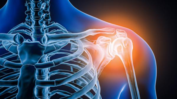 photo of Doctors took a look at man's painful shoulder—they found the joint was missing image