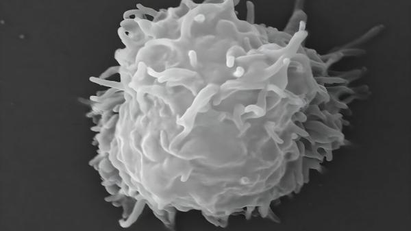 Man dies covered in necrotic lesions after amoebas eat him&hellip;