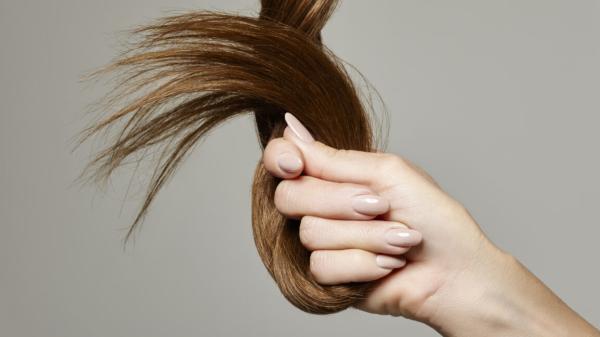 photo of Surgeons remove 2.5-inch hairball from teen with rare Rapunzel syndrome image