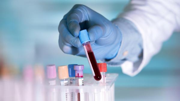 photo of Study Suggests AI-Generated Drug Could Slow Aging image