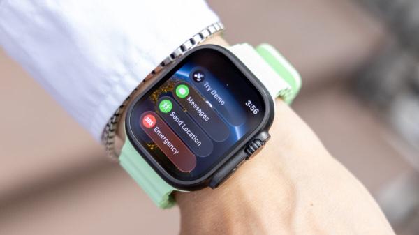 photo of The Next Apple Watch Might Address a Long-Term Sensor Shortcoming image