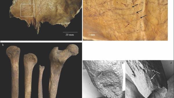 In Iron Age Scotland, People Removed the…