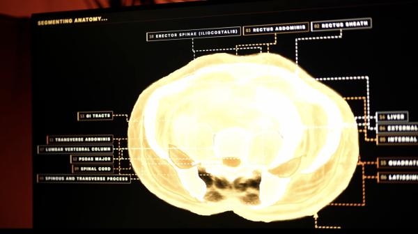 photo of Midjourney, the AI image generator, is developing a full-body ultrasonic scanner image
