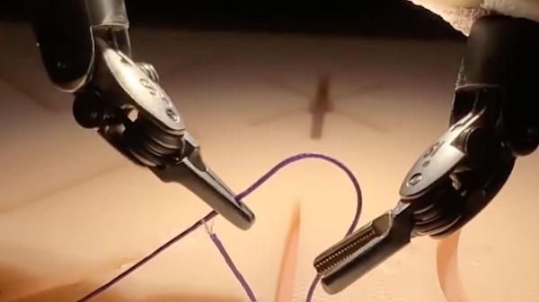 photo of Robotic AI performs successful surgery after watching videos for training image