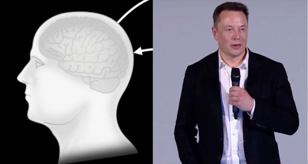 photo of Elon Musk to unveil Neuralink progress with real-time neuron demonstration this week image