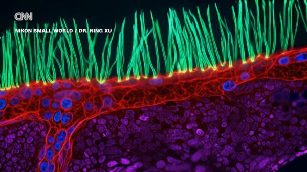 Contest-Winning Microscope Video Thrown…