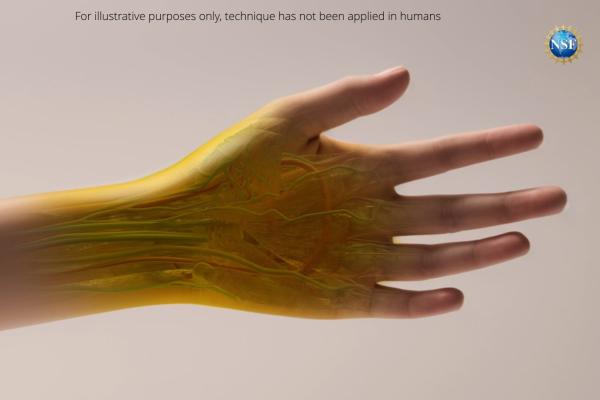 photo of Researchers Turn Skin Invisible Using Food Dye image