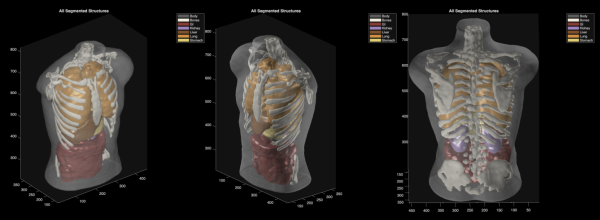 photo of Midjourney Medical goes from generating ‘cat images’ to full-body ultrasound scans image