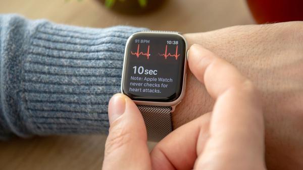 photo of Future Apple Watches could get a genius way to track your health, thanks to smart straps image