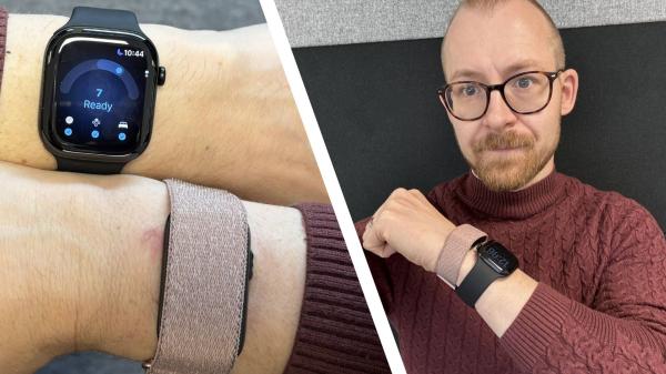 Apple Watch Series 12 vs Garmin Cirqa…